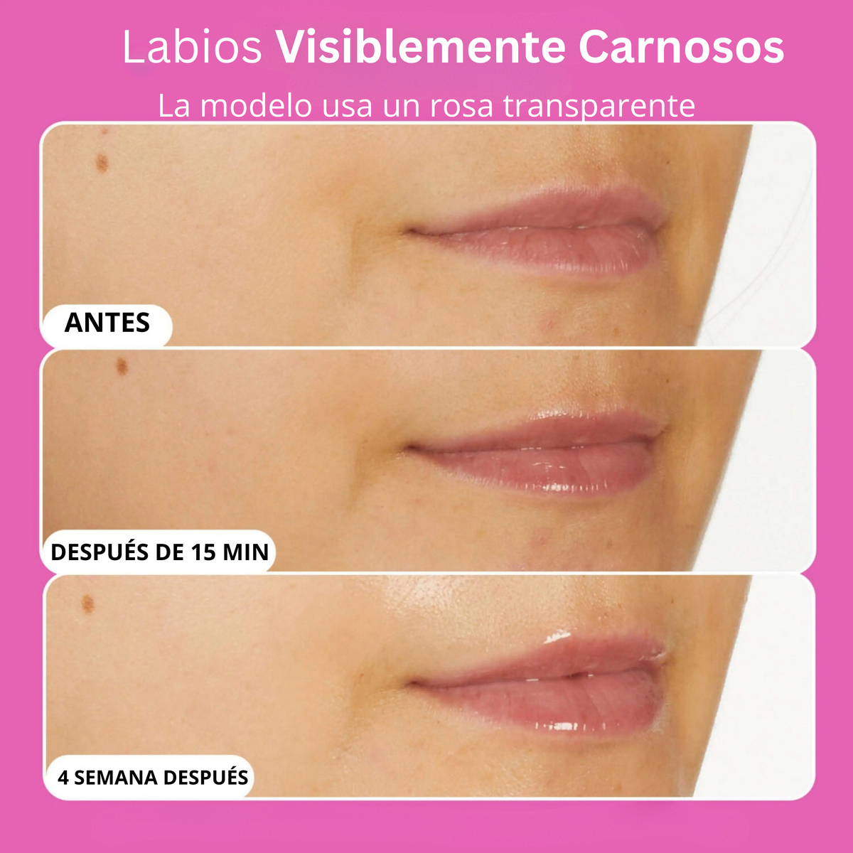 Voluminizadores para labios