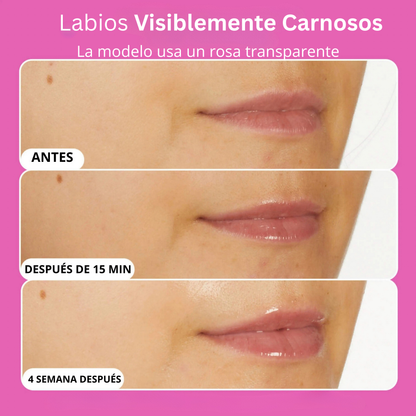 Voluminizadores para labios