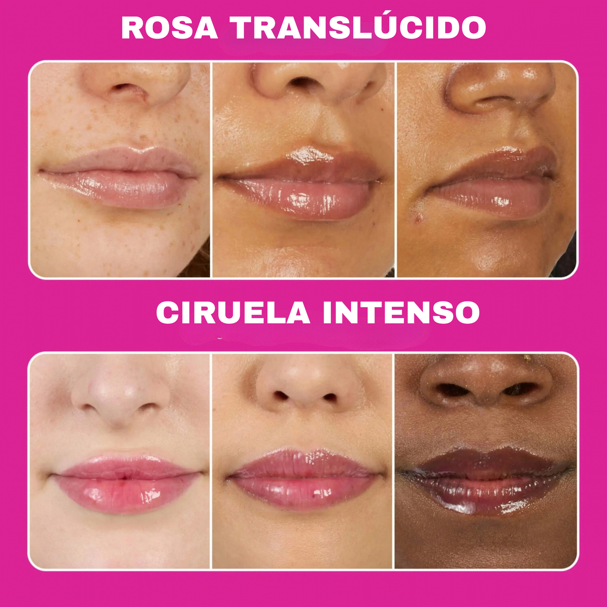 Voluminizadores para labios