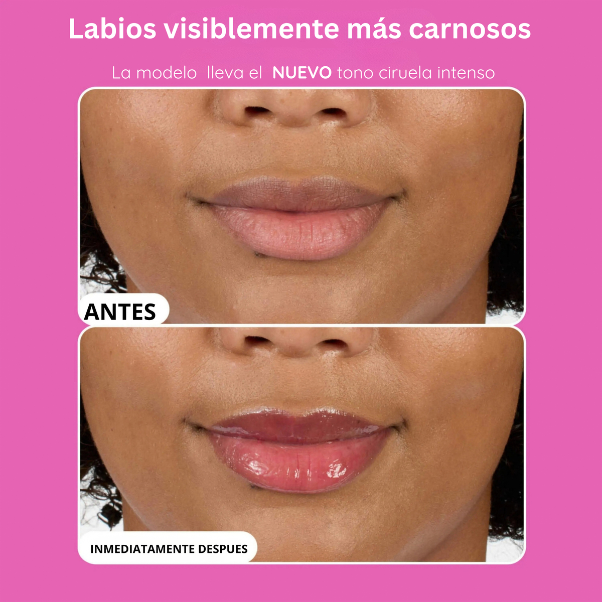 Voluminizadores para labios